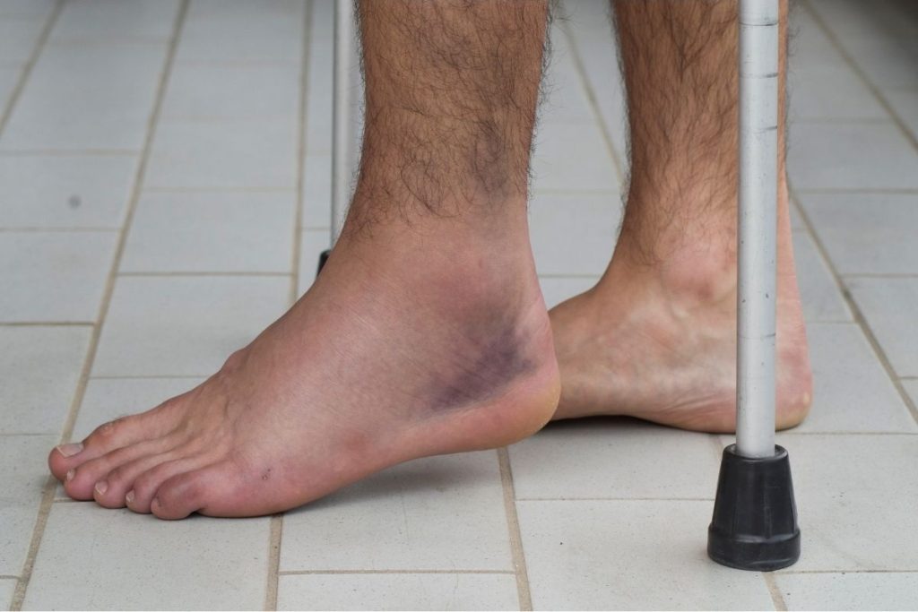 Prevención de lesiones en podología deportiva